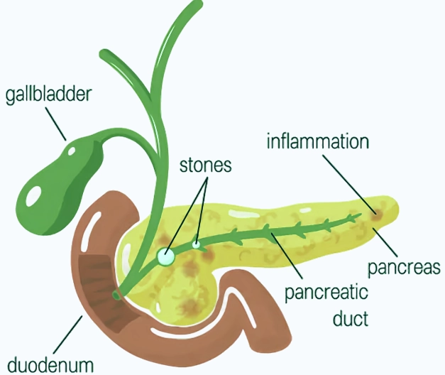 Pancragen: A Beneficial Aid for Pancreatic Health