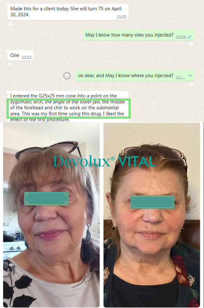 Patient feedback after using Devolux Vital