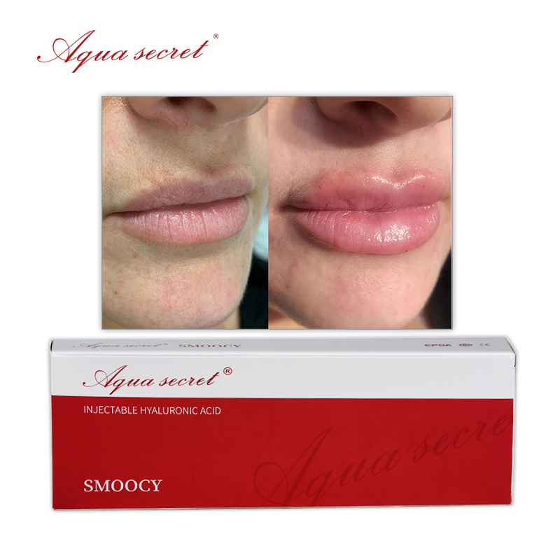 hyaluronic lip filler