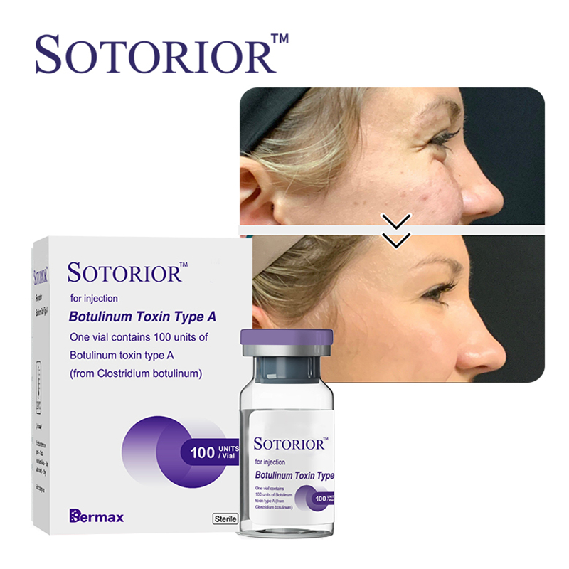 where can you get botulinum toxin