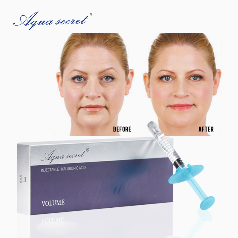 botulinum toxin and dermal fillers