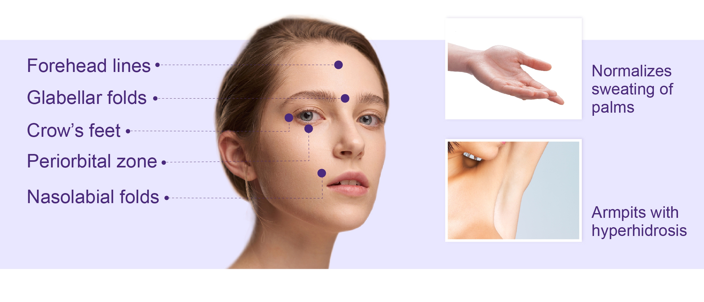 botulinum toxin treatment area