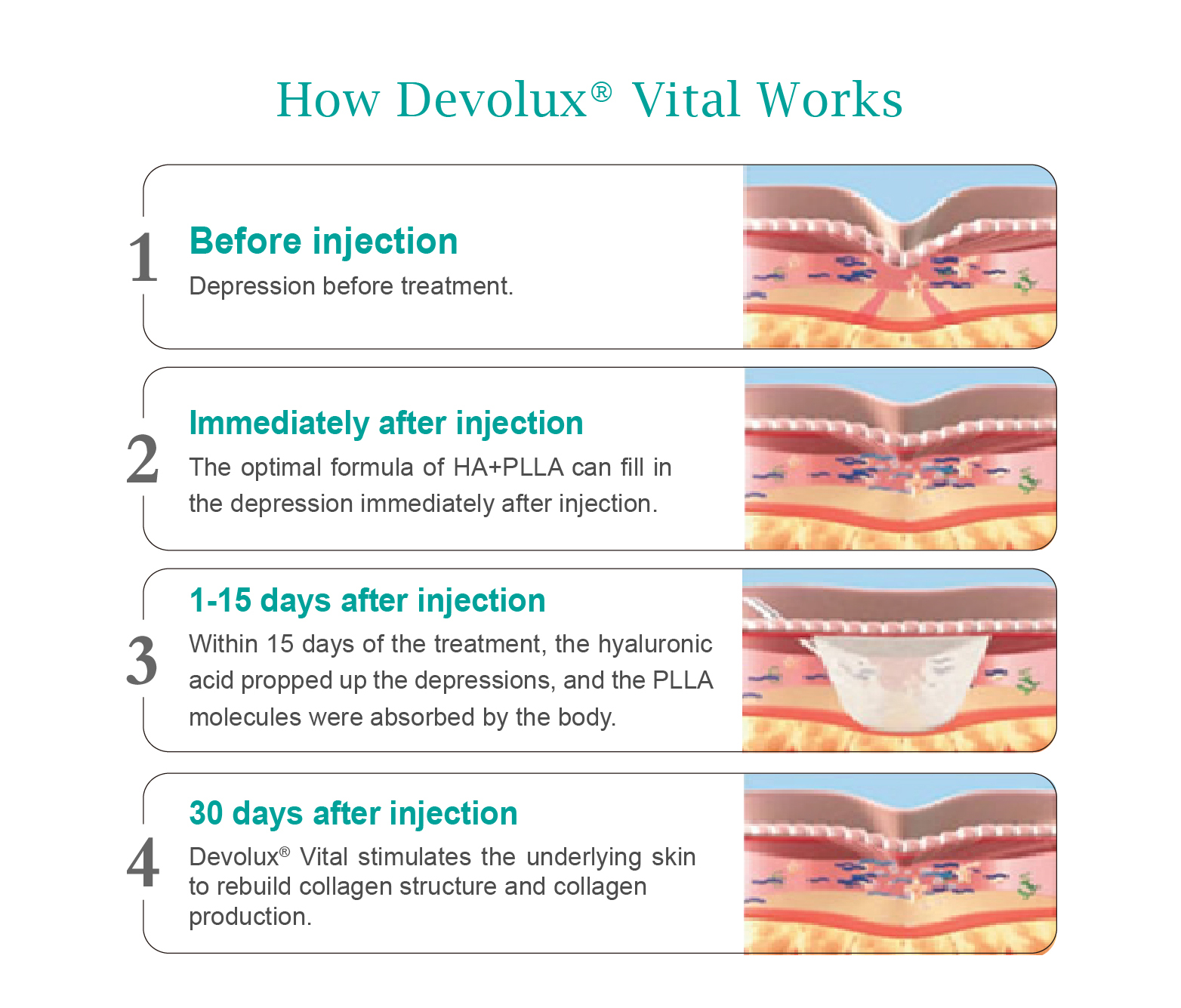 full face Devolux before and after photos