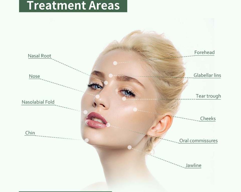 Treatment Areas