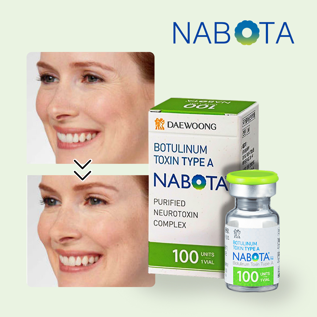 nabota botulinum toxin