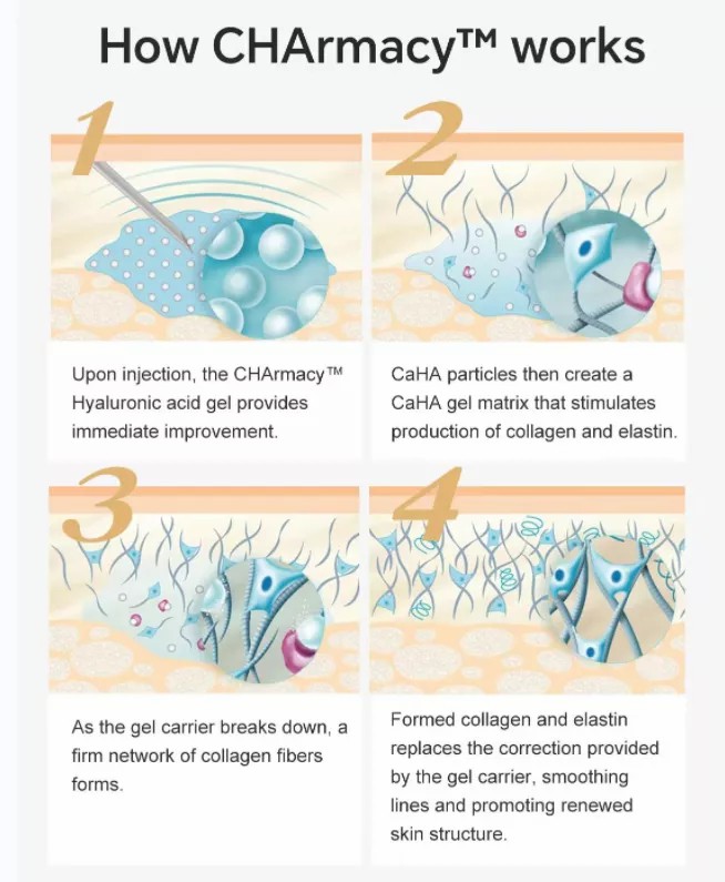 how calcium hydroxylapatite caha works