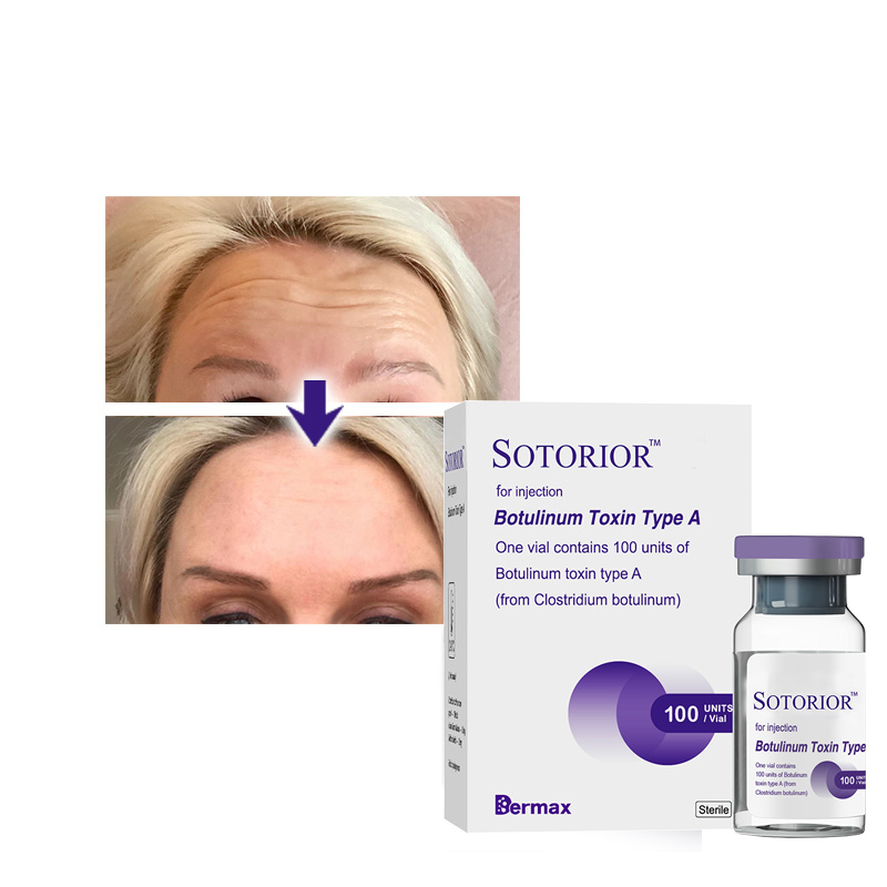 high-purity botulinum toxin sotorior