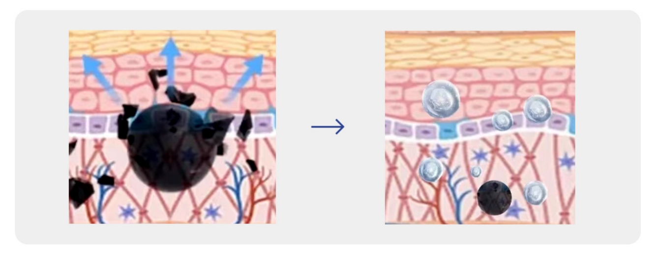 Buy EXOBLOOM Exosome