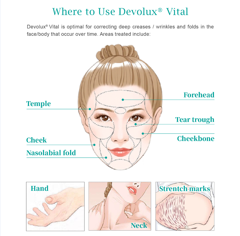 Poly L Lactic Acid vs Hyaluronic Acid: Compare Popular Dermal Filler