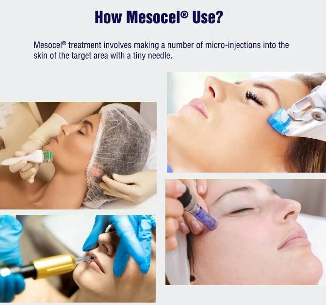 How collagen face injections use