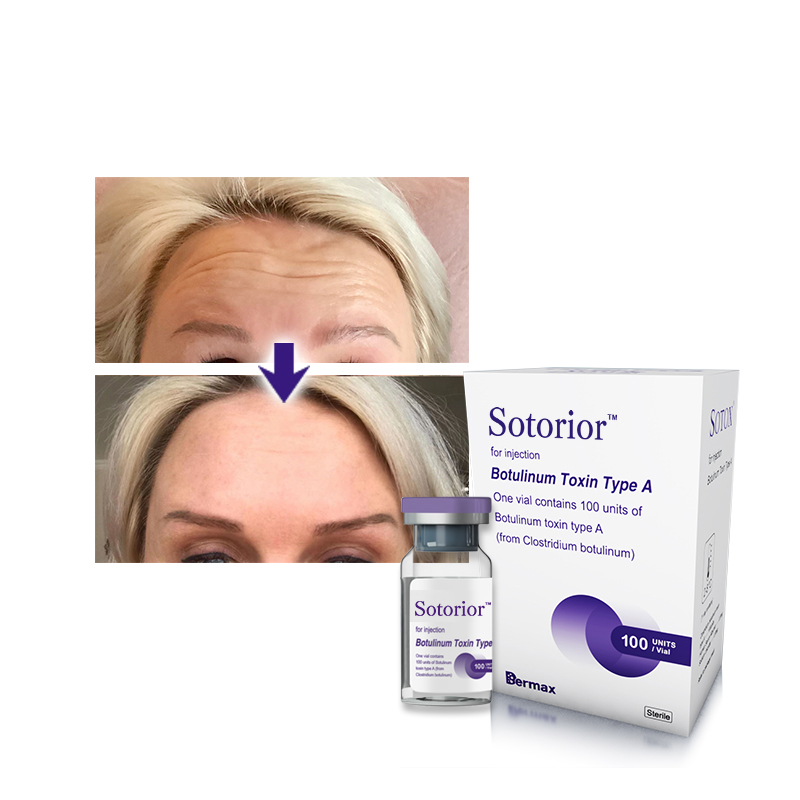 affordable botulinum toxin type a