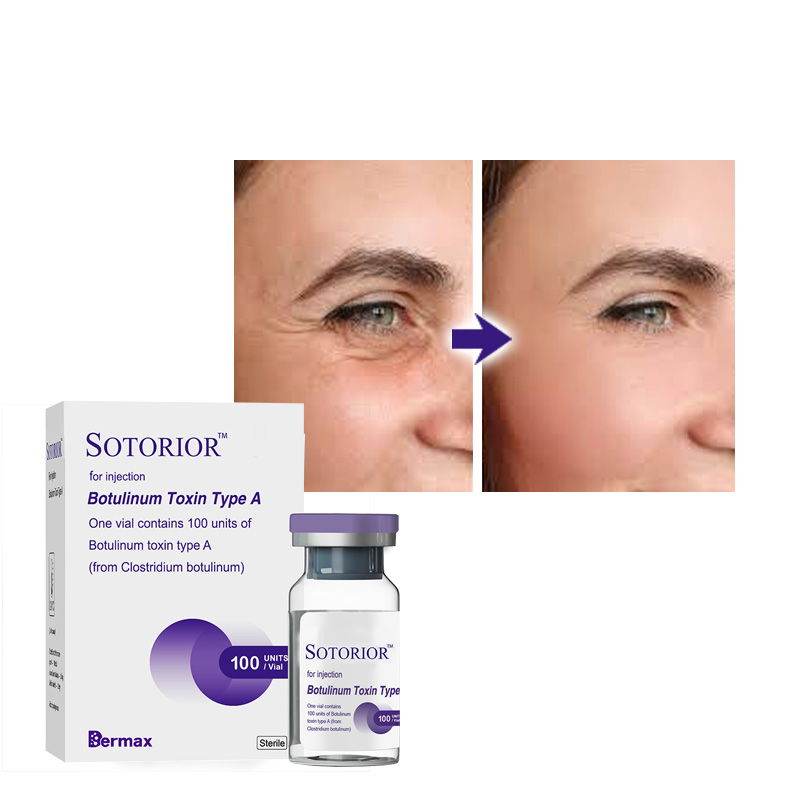 botulinum toxin type a buy