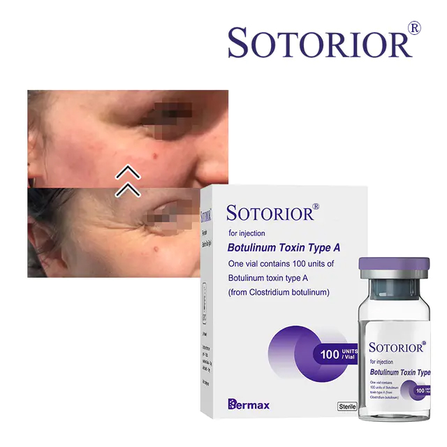 Wholesale Botulinum Toxin