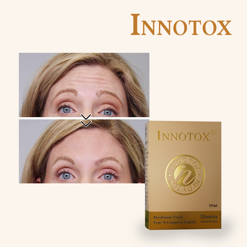 Innotox® vs Sotorior™