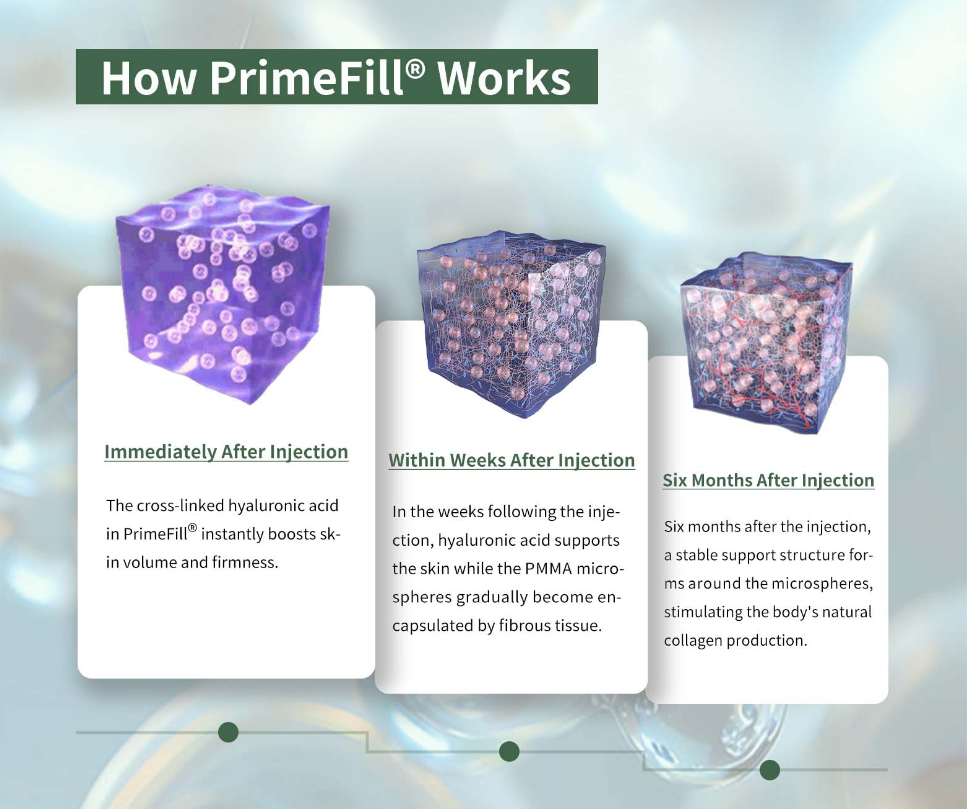 How PrimeFill® PMMA Filler Works