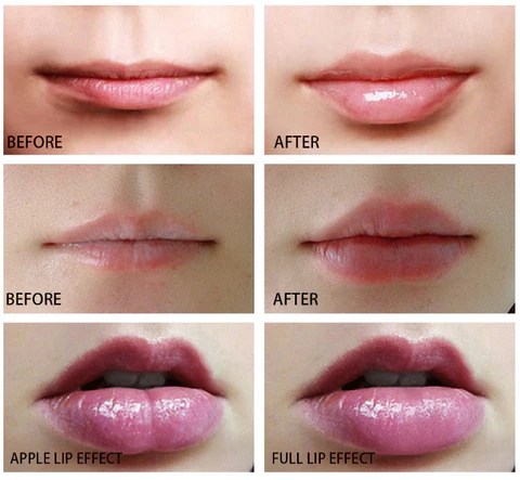 best lip plumper