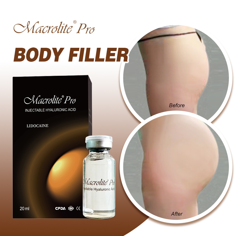 Macrolite® Pro Before & After