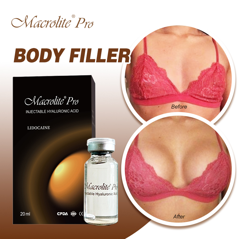 Macrolite® Pro Before & After